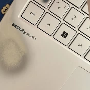 Casper Nirvana S200 Dizüstü Bilgisayarda Garanti Sürecinde Yanık Sorunu Ve Servis Mağduriyeti!