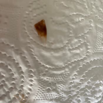 Çikolatanın İçinden Yabancı Madde Çıktı, Yaralandım!