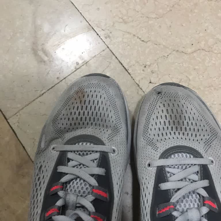 Skechers Ayakkabıda Tek Taraflı Açılma Ve Garanti Reddi Mağduriyeti