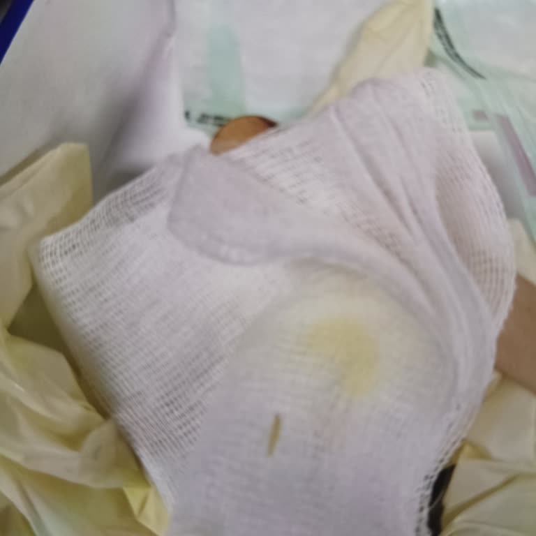 Bisküvi İçinden Çıkan Sert Yulaf Parçası Sağlığımı Tehlikeye Attı