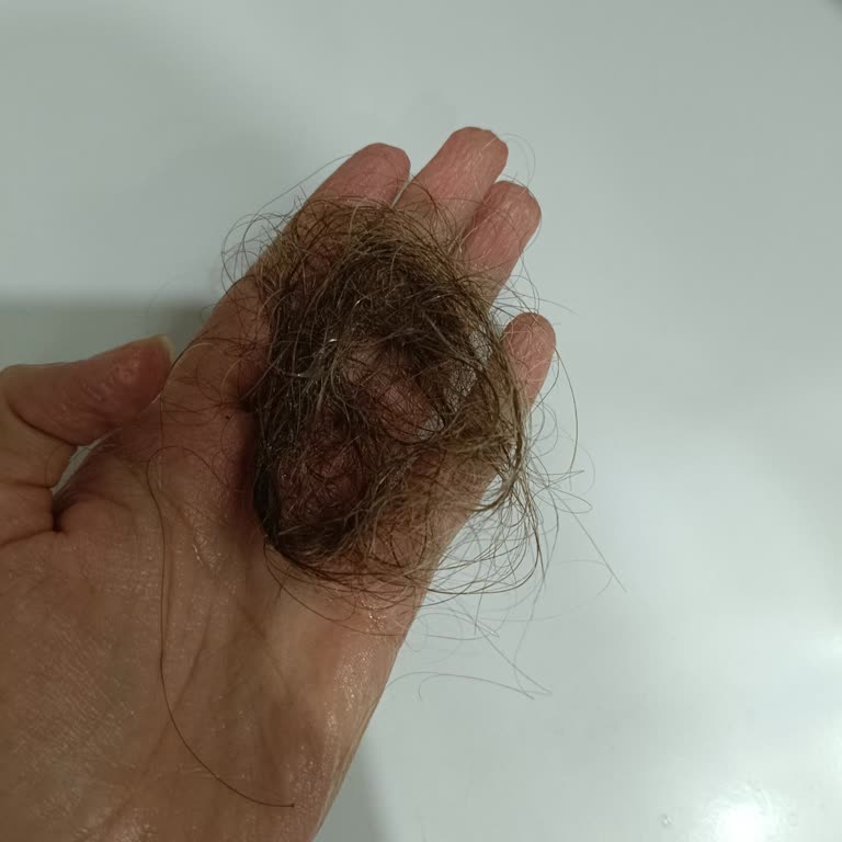 Otacı Sarımsaklı Şampuan Saç Dökülmesini Artırdı Saçlarımız İnceldi Ve Güçsüzleşti