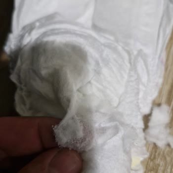 Molfix 4 Numara Bebek Bezinde Alerji Ve Ürün Kalitesi Sorunu