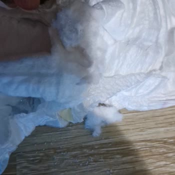 Molfix 4 Numara Bebek Bezinde Alerji Ve Ürün Kalitesi Sorunu