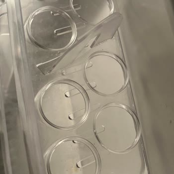 Yanıltıcı Fotoğraflar, Kötü Temizlik Ve Haksız Ücretlendirme Nedeniyle Tatil Hayal Kırıklığı