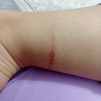 İlk Giyişte Ayağımı Yaralayan Bot İçin İade Talebi