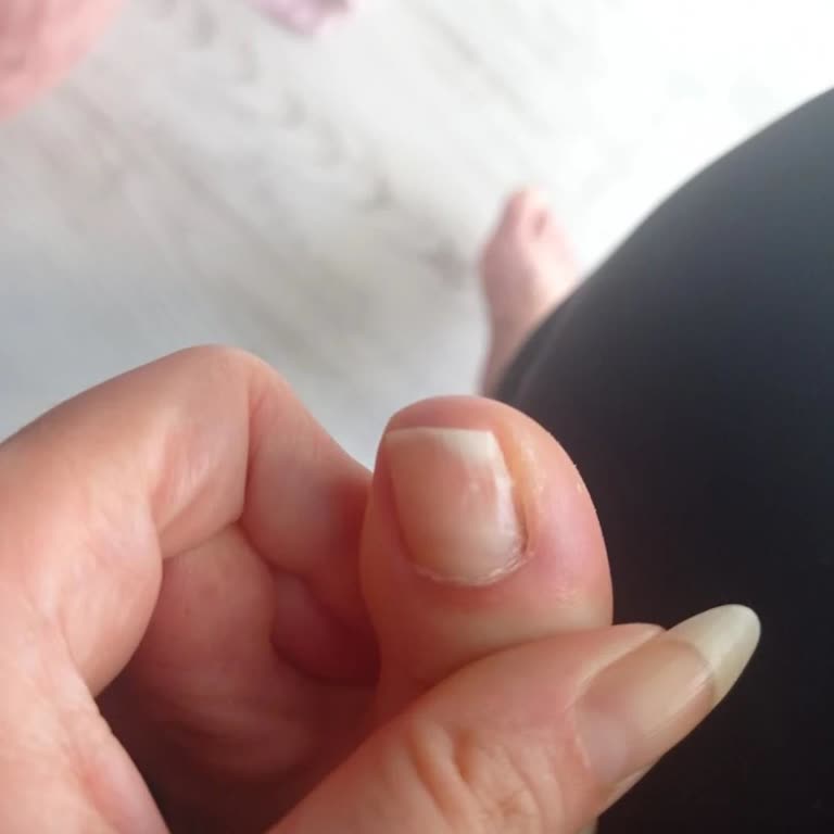 Hijyen Eksikliği Ve Kaba Davranışlar Nedeniyle Sağlık Sorunu Yaşadım