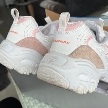 Tek Ayakkabıda Renk Solması Ve Garanti Reddiyle Mağduriyet