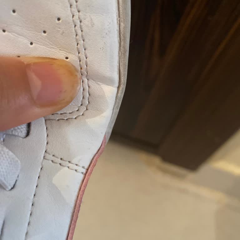 Kısa Sürede Açılan Ayakkabı İçin Değişim Talebi Ve Olumsuz Garanti Sonucu