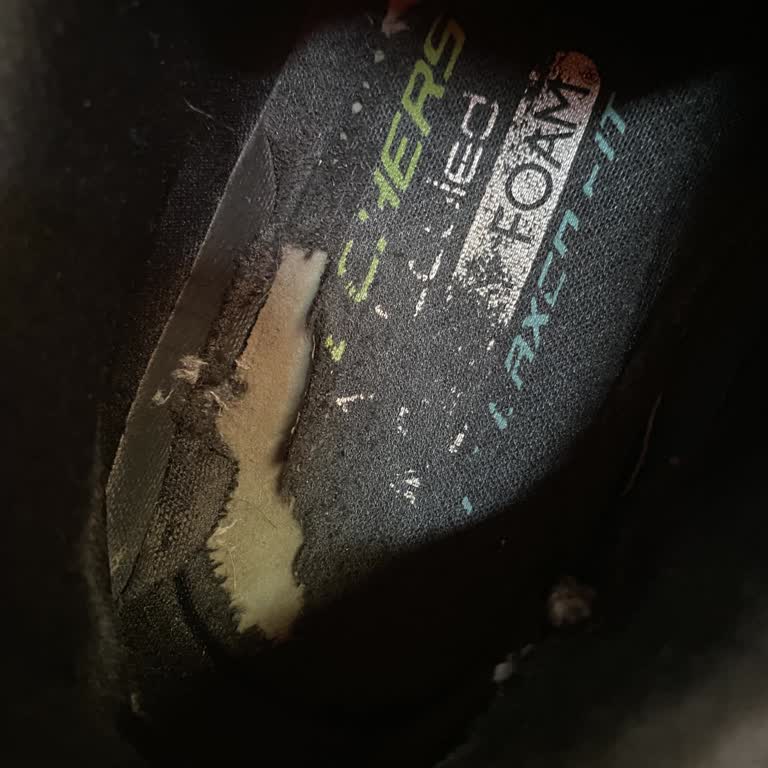 Garantili Ayakkabım 8 Ayda Deforme Oldu, Talebim Reddedildi!