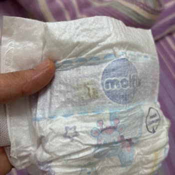 Siparişten Çıkan Küflü Bebek Bezi Hayal Kırıklığı Yarattı