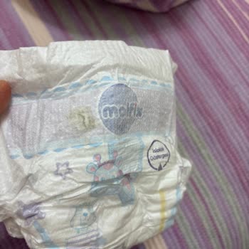 Siparişten Çıkan Küflü Bebek Bezi Hayal Kırıklığı Yarattı