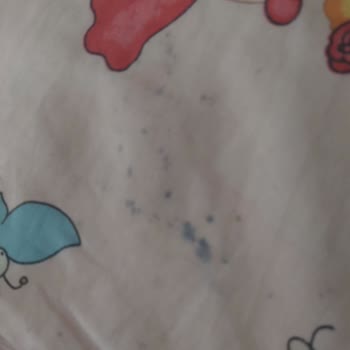 Saç Boyası Sürekli Akıyor Ve Saç Dökülmesi Başladı