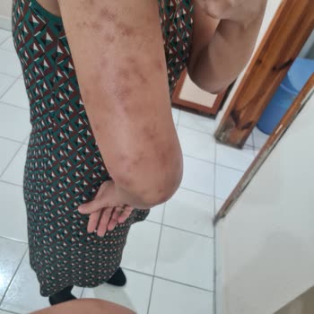 Kamil Koç Otobüsünde Temizlik Eksikliği Nedeniyle Sağlık Sorunları Yaşadım