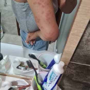 Kamil Koç Otobüsünde Temizlik Eksikliği Nedeniyle Sağlık Sorunları Yaşadım