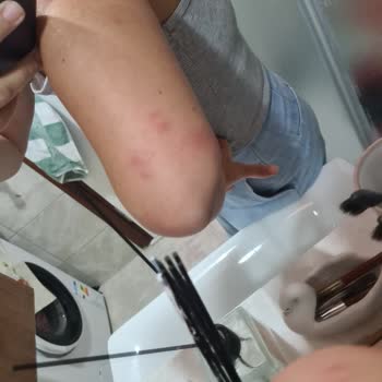 Kamil Koç Otobüsünde Temizlik Eksikliği Nedeniyle Sağlık Sorunları Yaşadım