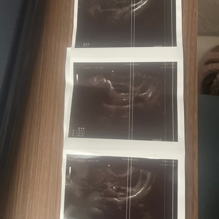 Pendik Bölge Hastanesi Yanlış Tedavi ve İletişim Nedeniyle Mağduriyet Yaşadım