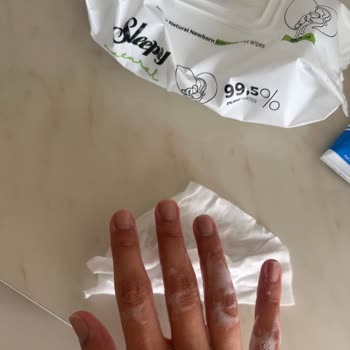 Sleepy Natural Islak Mendil Cildimde Kızarıklık Ve Güvensizlik Yarattı