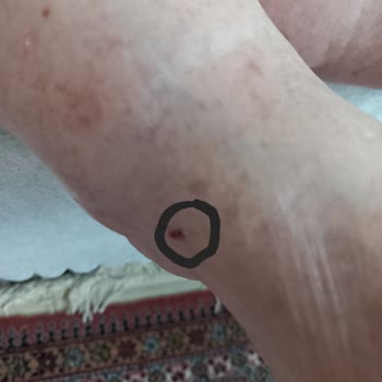 Ceyo Terlik Yaraladı, Değişim Talebim Reddedildi Ve Ürün Kayboldu