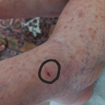 Ceyo Terlik Yaraladı, Değişim Talebim Reddedildi Ve Ürün Kayboldu