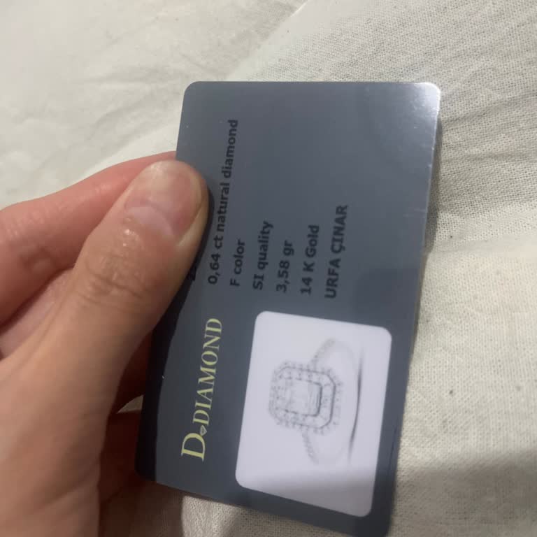 Baget Yüzüğüm Kısa Sürede Deforme Oldu Ve Taş Düştü