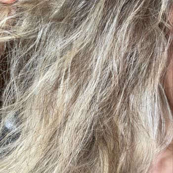 Dyson Servisi Ürünümü Kırdı, Saçlarım Yandı, Çözüm Yok!