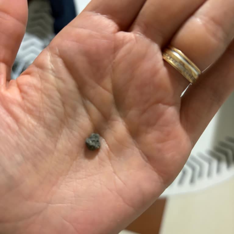 Patlatmalık Mısırdan Çıkan Taş Çocuğumun Sağlığını Riske Attı