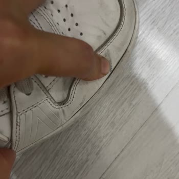 Satın Aldığım Ayakkabıda Kısa Sürede Oluşan Deformasyon Ve Mağaza İlgisizliği