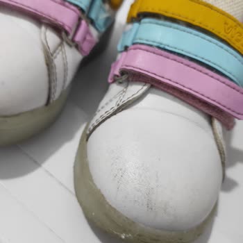 Vicco Ayakkabıda Deformasyon Ve İlgisiz Müşteri Hizmetleri Mağduriyeti