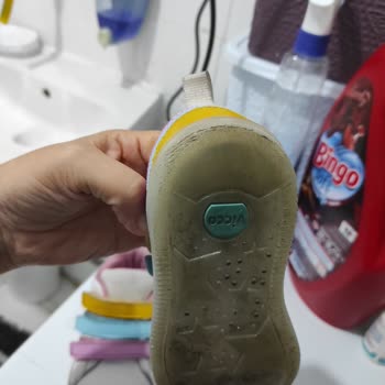 Vicco Ayakkabıda Deformasyon Ve İlgisiz Müşteri Hizmetleri Mağduriyeti