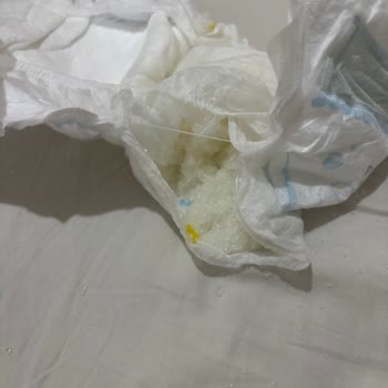 Molfix Premium Bebek Bezinde Sızdırma Ve Yırtılma Sorunu, Müşteri Hizmetlerine Ulaşılamıyor