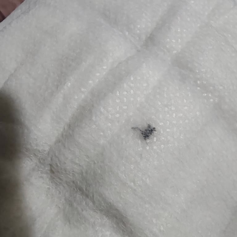 Aldığım Bebek Bezinden Ölü Böcek Çıktı, Hijyen Konusunda Endişeliyim