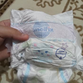 Molfix 5 Numara 100’lü Bebek Bezi Ciltte Pişik Ve Kalite Sorunu Yaşattı!