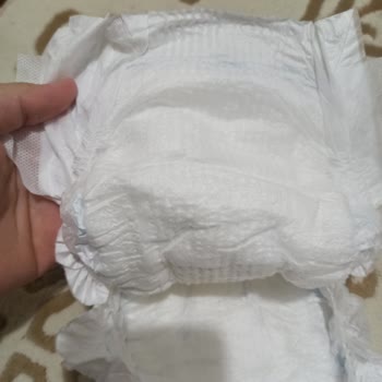 Molfix 5 Numara 100’lü Bebek Bezi Ciltte Pişik Ve Kalite Sorunu Yaşattı!