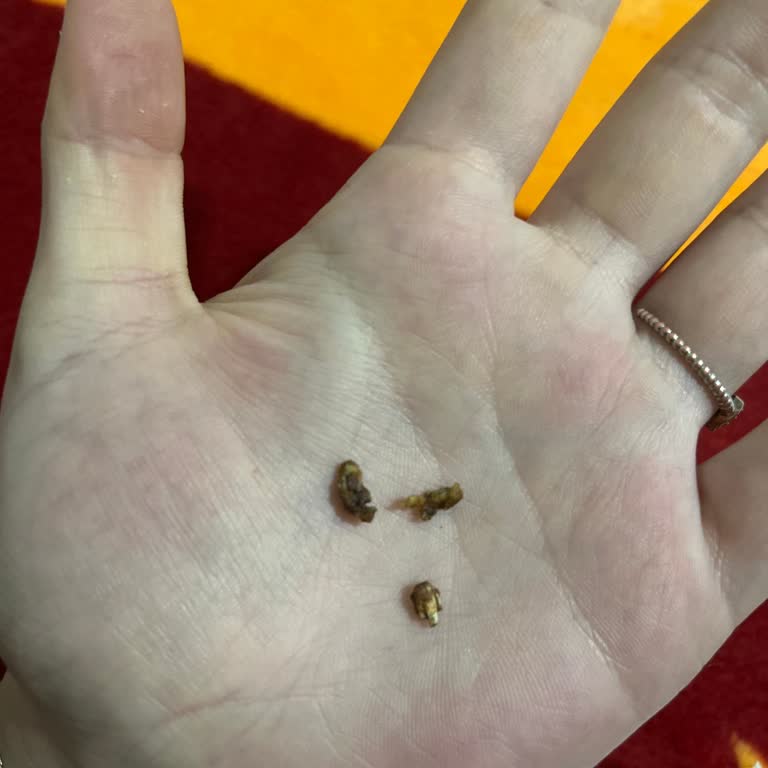 Çikolatadan Çıkan Sert Parçalar Dişimi Zedeledi, Çocuklar İçin Riskli Olabilir