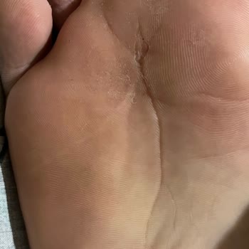 FLO Mağazasından Aldığım Puma Ayakkabı 6 Ayda Dağıldı, Mağaza Müdüründen Kaba Davranış