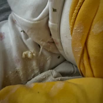 Bebelac Gold 3 Mama Kötü Koktu Bebeğimiz Hastanelik Oldu