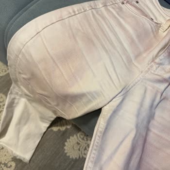 Zara'dan Alınan Ceket Kısa Sürede Kıyafetlerimi Boyadı, İade Talebim Reddedildi