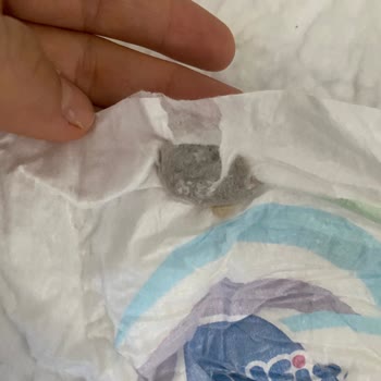 Bebek Bezinde Leke Sorunu Ve Hayati Risk Endişesi