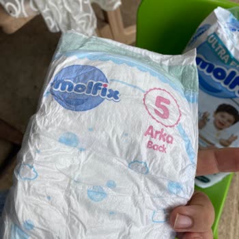 Molfix Premium Bebek Bezi Paketi İçeriği Beklendiği Gibi Çıkmadı