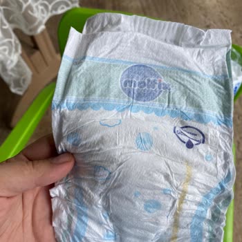 Molfix Premium Bebek Bezi Paketi İçeriği Beklendiği Gibi Çıkmadı