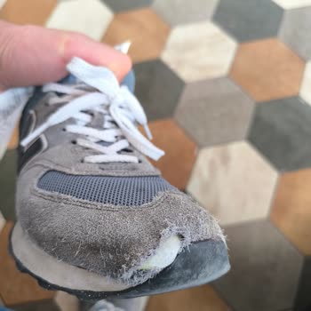 I Face Defect on New Balance 574 Shoes — Store Refused Help After Warranty