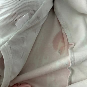 Molfix Bebek Bezi Sürekli Sızdırıyor Bebeğimin Uykusu Bölünüyor