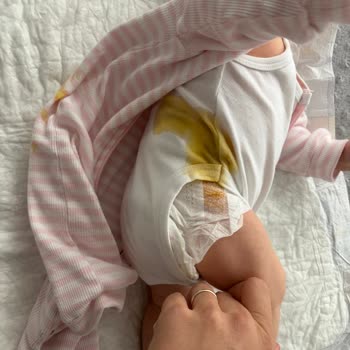 Molfix Bebek Bezi Sürekli Sızdırıyor Bebeğimin Uykusu Bölünüyor