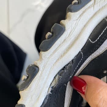 Skechers Ayakkabıda Erken Açılma Ve Garanti Kapsamında Red