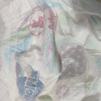 Molfix 5 Numara Külot Bezde Bant Eksikliği Ve Sızdırma Sorunu