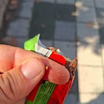 Çokonat İçinden Taş Çıktı, Sağlığım Tehlikeye Girdi