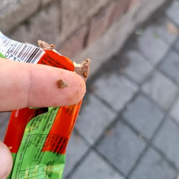 Çokonat İçinden Taş Çıktı, Sağlığım Tehlikeye Girdi