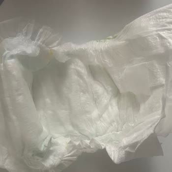 Eski Üretim Bebek Bezi Bebeğimde Pişiğe Neden Oldu, Mağduriyetimin Giderilmesini İstiyorum