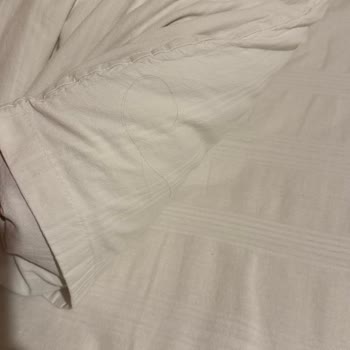 Hijyen Sorunları Ve İlgisiz İşletme Nedeniyle Otelden Kovulup İade Alamadım