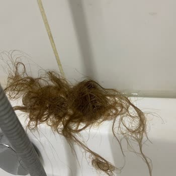 Saç Boyası Sonrası Ciddi Zarar Ve Müşteri Hizmetlerine Ulaşılamıyor